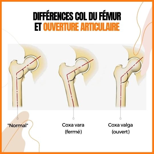 stretchingpro-étirements-bas-corps-anatomie-adducteurs-grand-écart-col-fémur